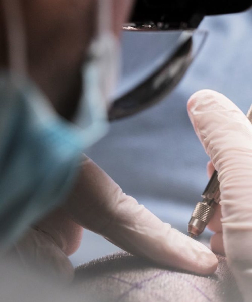 Médecin DHI réalisant une intervention capillaire de précision