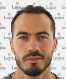 Exemple de vue de face