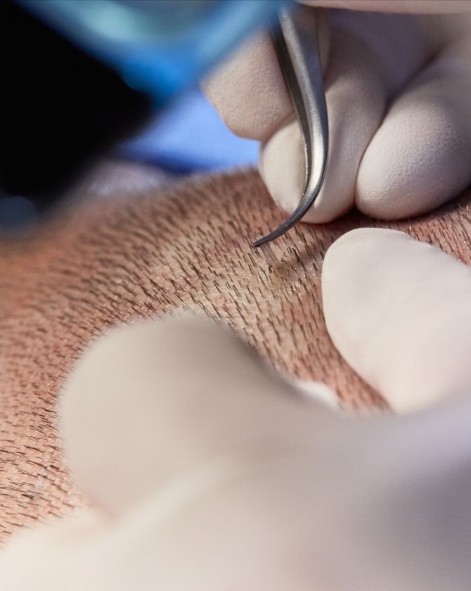 Extraction en douceur