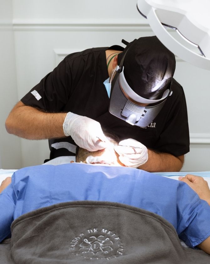 Extraction des implants capillaires DHI à Paris